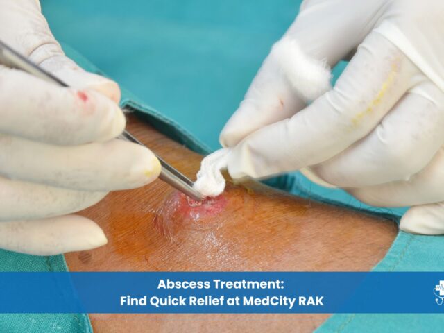 Abscess Treatment Find Quick Relief at MedCity RAK