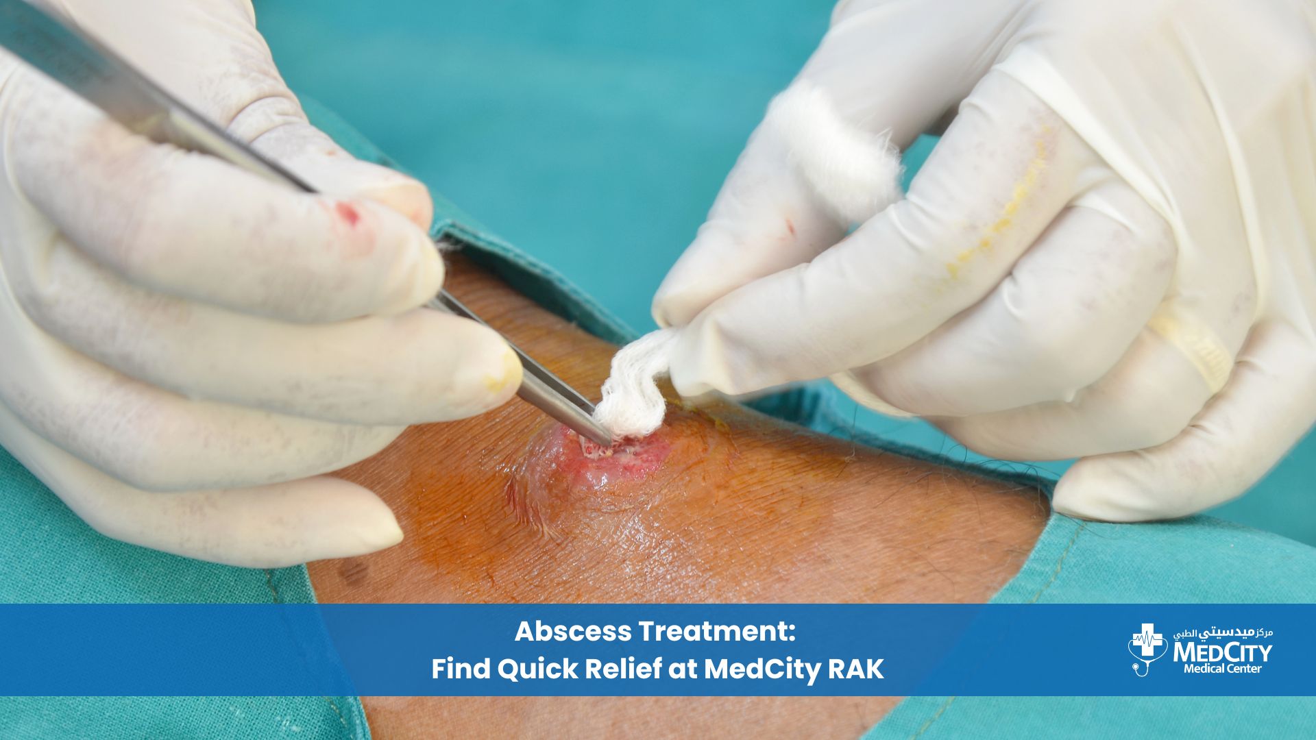 Abscess Treatment Find Quick Relief at MedCity RAK