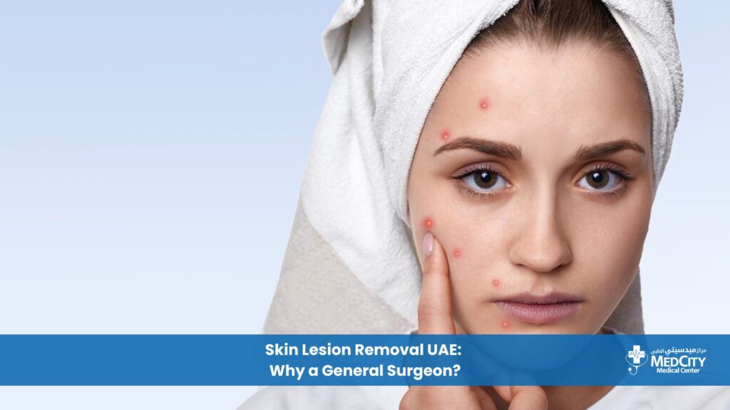 Skin Lesion Removal in UAE Why a General Surgeon