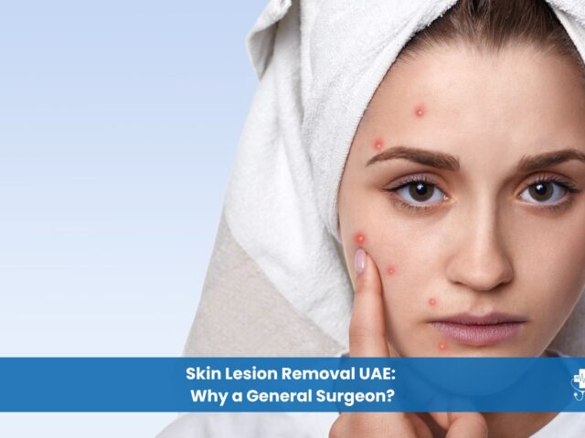 Skin Lesion Removal in UAE Why a General Surgeon