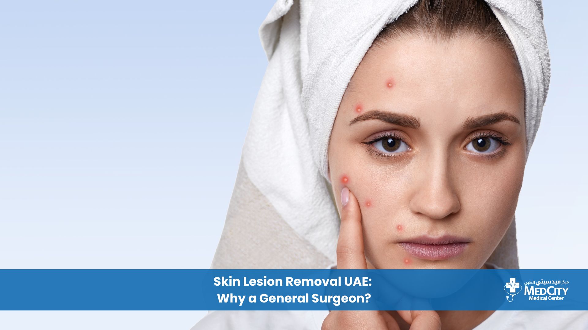 Skin Lesion Removal in UAE Why a General Surgeon