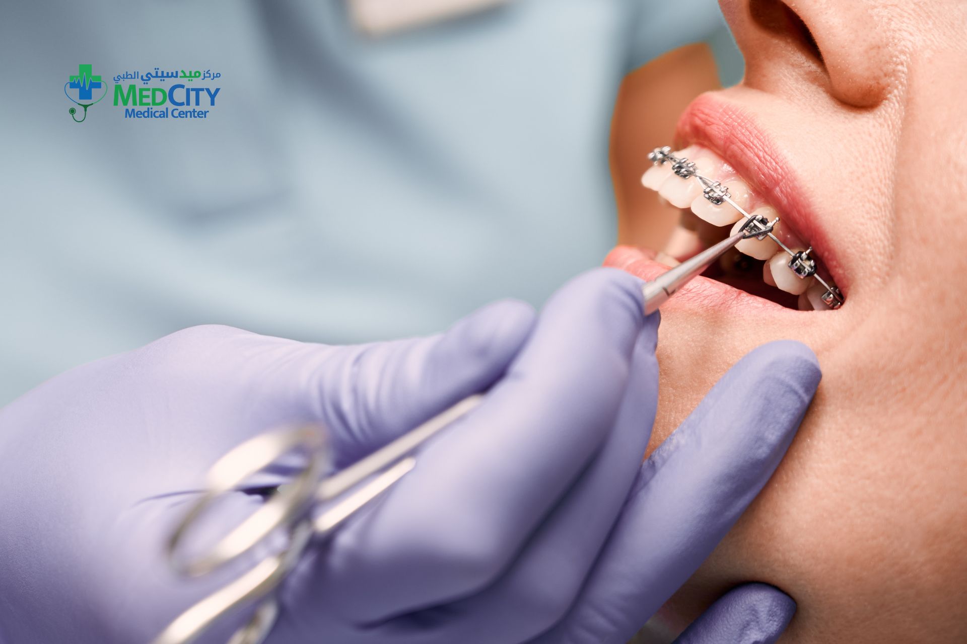 Orthodontics Invisalign Retainers Aligners in Ras Al Khaimah