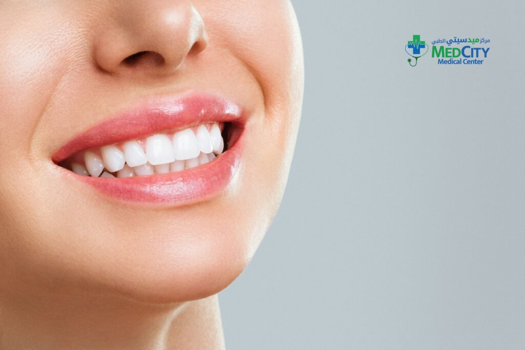 Smile Makeover in Ras Al Khaimah
